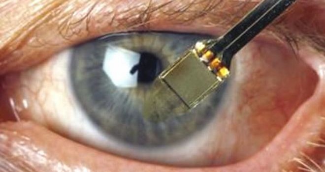 IMPLANTES SOLARES PODRÍAN AYUDAR A RECUPERAR LA VISTA